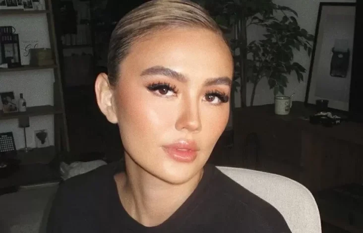 Mengenal Alopecia Areata, Penyakit yang dimaksud yang dimaksud Menjangkit Agnez Mo hingga Alami Kebotakan